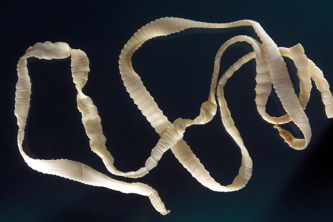 A Taenia solium tapeworm. Photo: Alamy