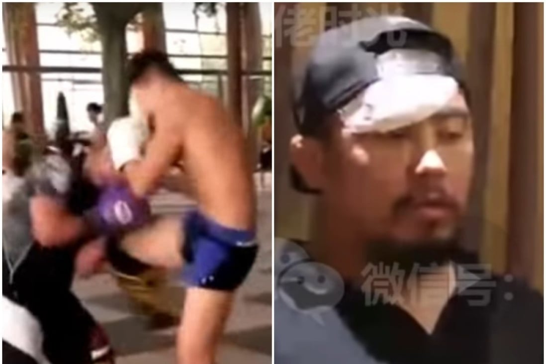 The Time Xu Xiaodong Got His Skull Fractured By A Muay Thai Kick Boxer In A Sparring Session South China Morning Post