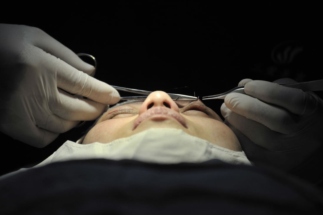 A Chinese woman undergoes facial cosmetic surgery at a hospital in Lanzhou, Gansu province, China. More than half the country’s plastic surgery clients in 2018 were under 28 years old, and 8 per cent were under 18. Photo: AFP