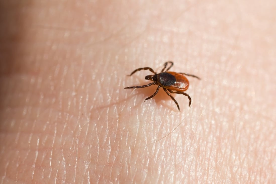 Lyme disease affects 400,000 Americans each year. File photo: TNS