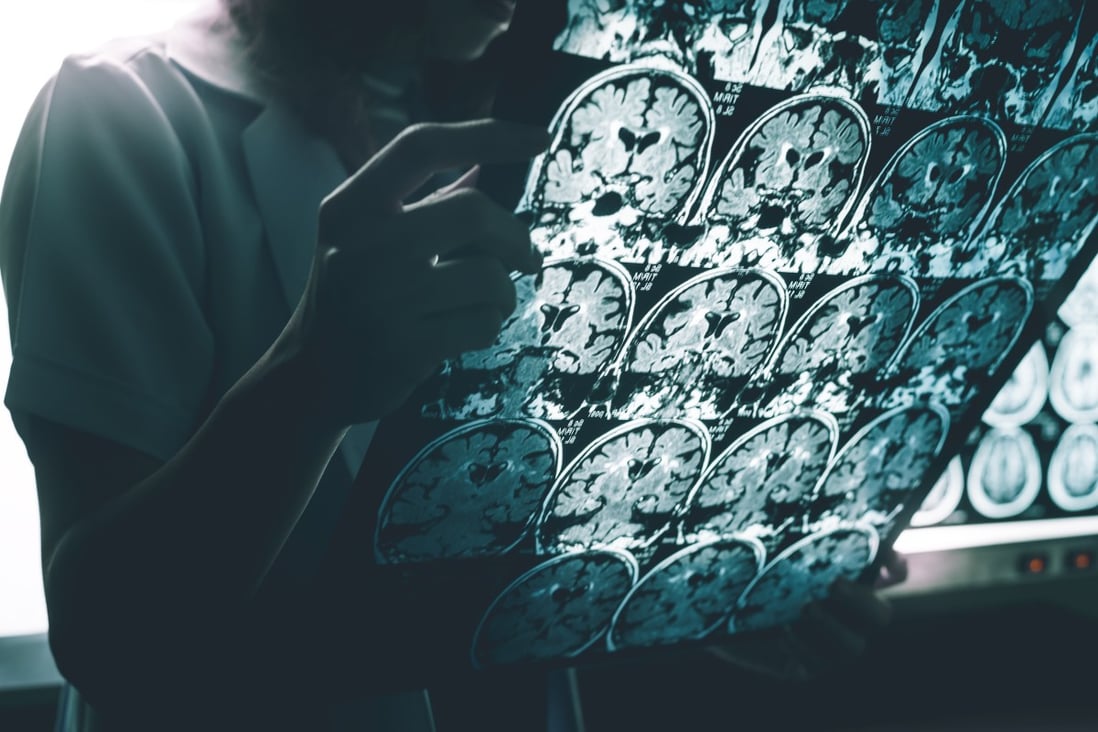 Chinese scientists are awaiting approval of their seaweed-based drug that could ease the ravages of Alzheimer’s disease. Photo: Shutterstock