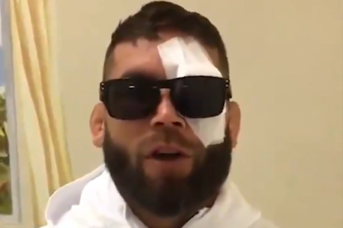 Jeremy Stephens speaks to ESPN’s Karyn Bryant with a bandage on his left eye after his fight against Yair Rodriguez ends in a no contest after 15 seconds. Photo: Twitter/@KarynBryant