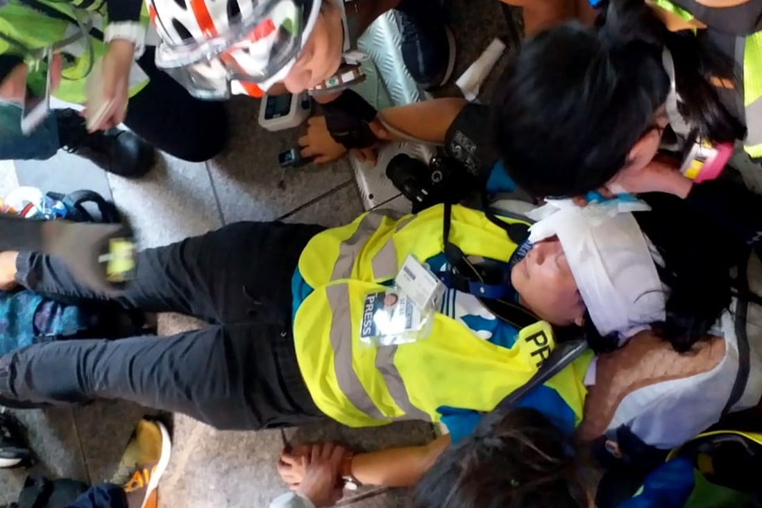 Veby Mega Indah, an associate editor at Suara Hong Kong News, was on Sunday struck in the face by a non-lethal round fired by police. Photo: Mimi Lau