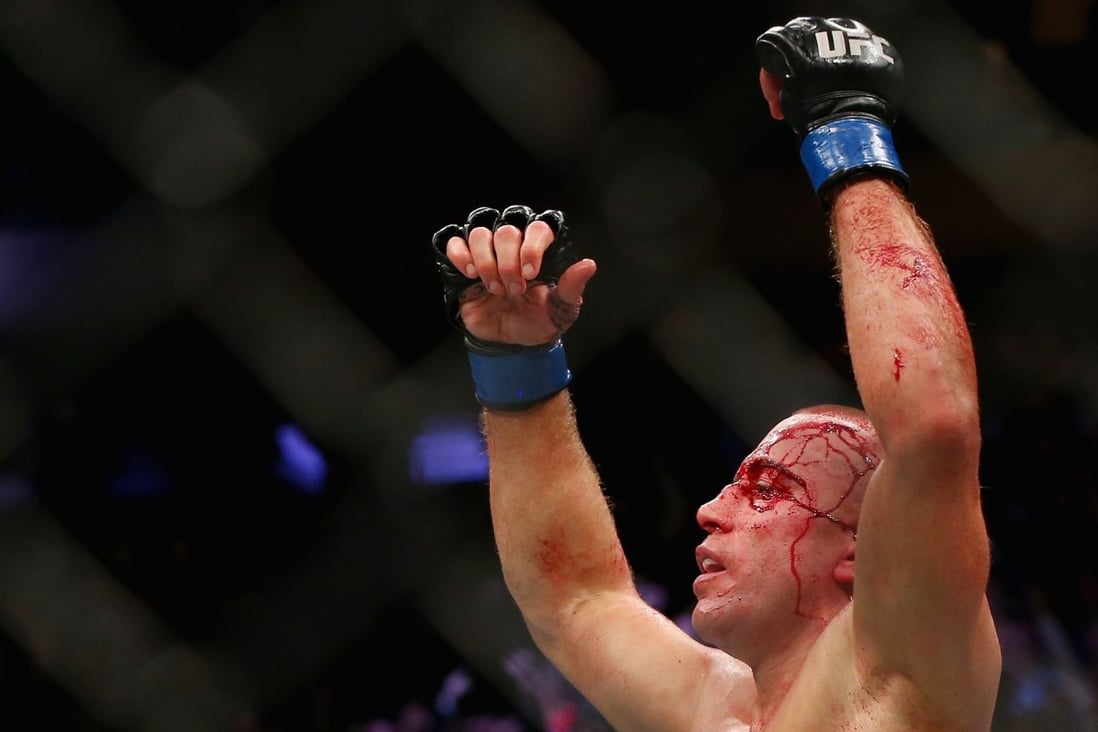 Georges St-Pierre should most definitely not come out of retirement, again. Photo: AFP