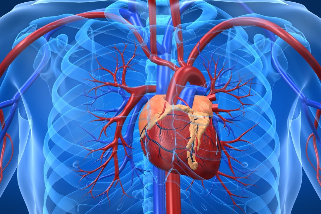 Heart diseases cost the US some US$555 billion in 2016, which is forecast to double to US$1.1 trillion by 2035, including health care services, medication and lost productivity, according to American Heart Association. Photo: Alamy