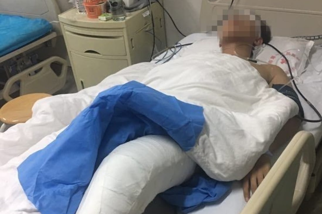 The student pictured in hospital after the attack. Photo: Weibo