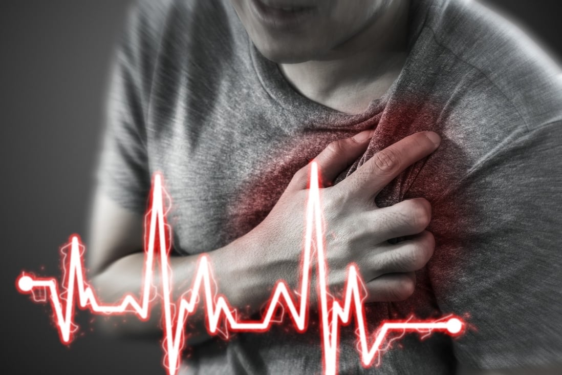 Remembering how to deal with cardiac emergencies can help to increase awareness about – and the chances of surviving a heart attack. Source: Shutterstock