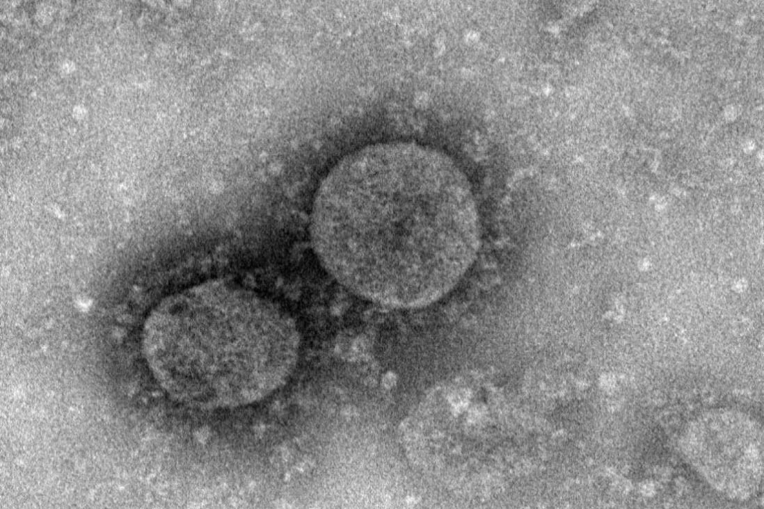 The previously unknown coronavirus has killed more than 100 people and infected thousands. Photo: National Microbiology Data Centre