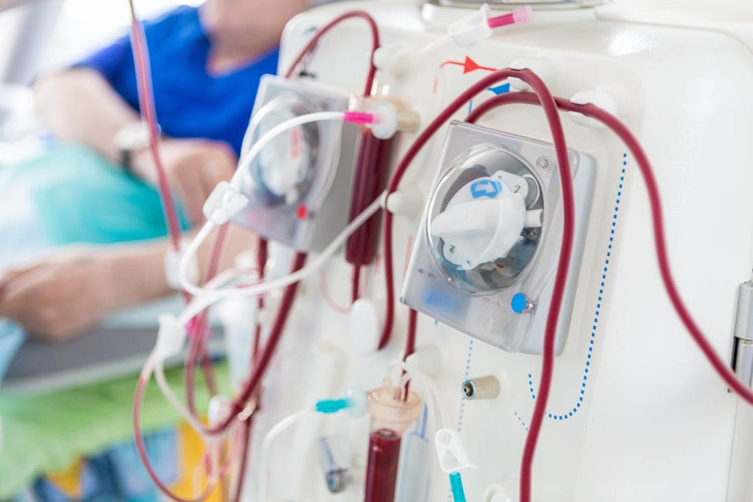 Dialysis is the only option for those whose kidneys are no longer able to perform their function naturally, aside from a kidney transplant. Photo: Shutterstock