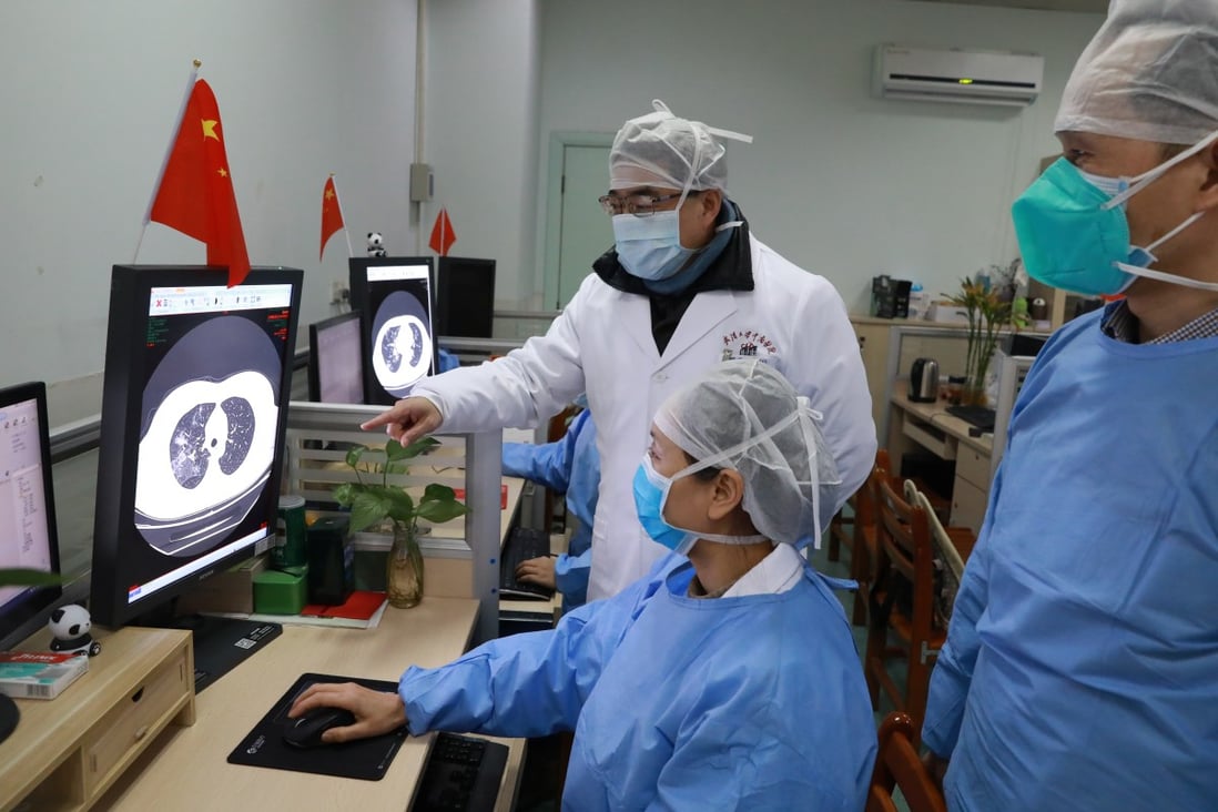 Medical workers inspect a CT scan image of a patient at Wuhan University’s Zhongnan Hospital on Sunday. Photo: China Daily via Reuters