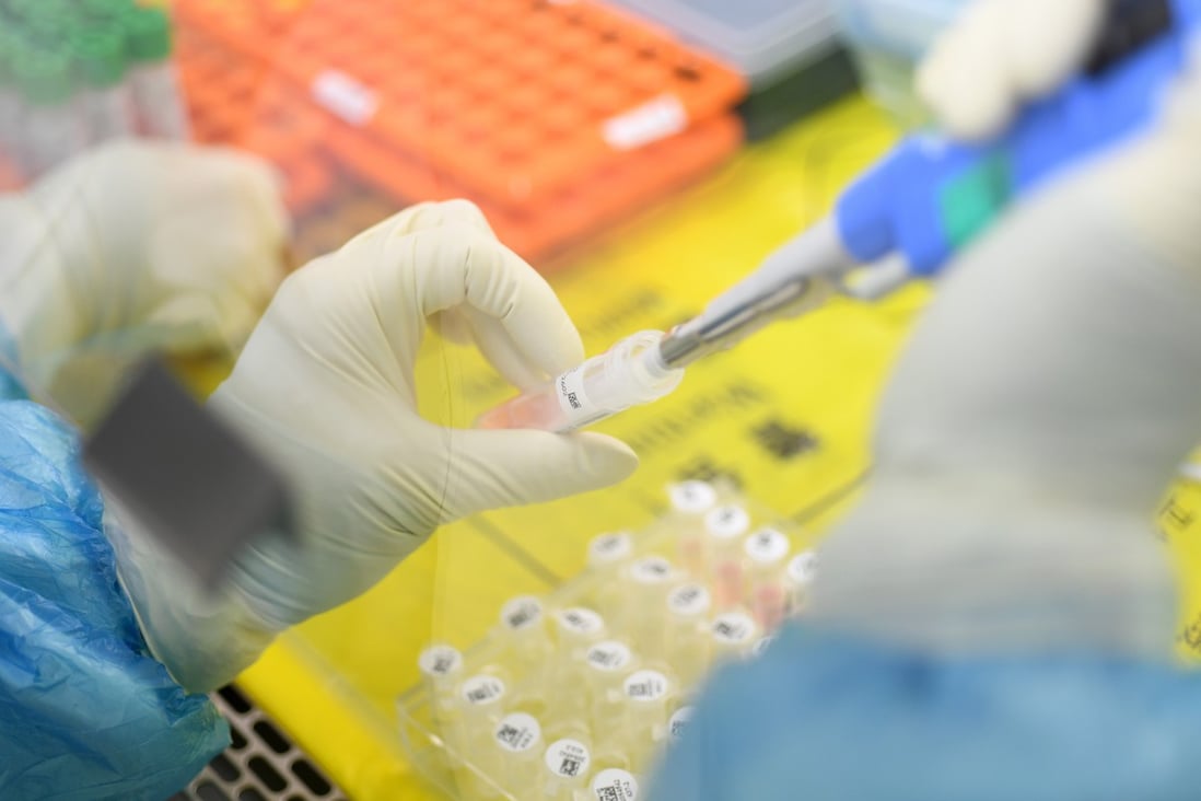 A laboratory technician tests biological samples for coronavirus in Wuhan, China. Photo: EPA