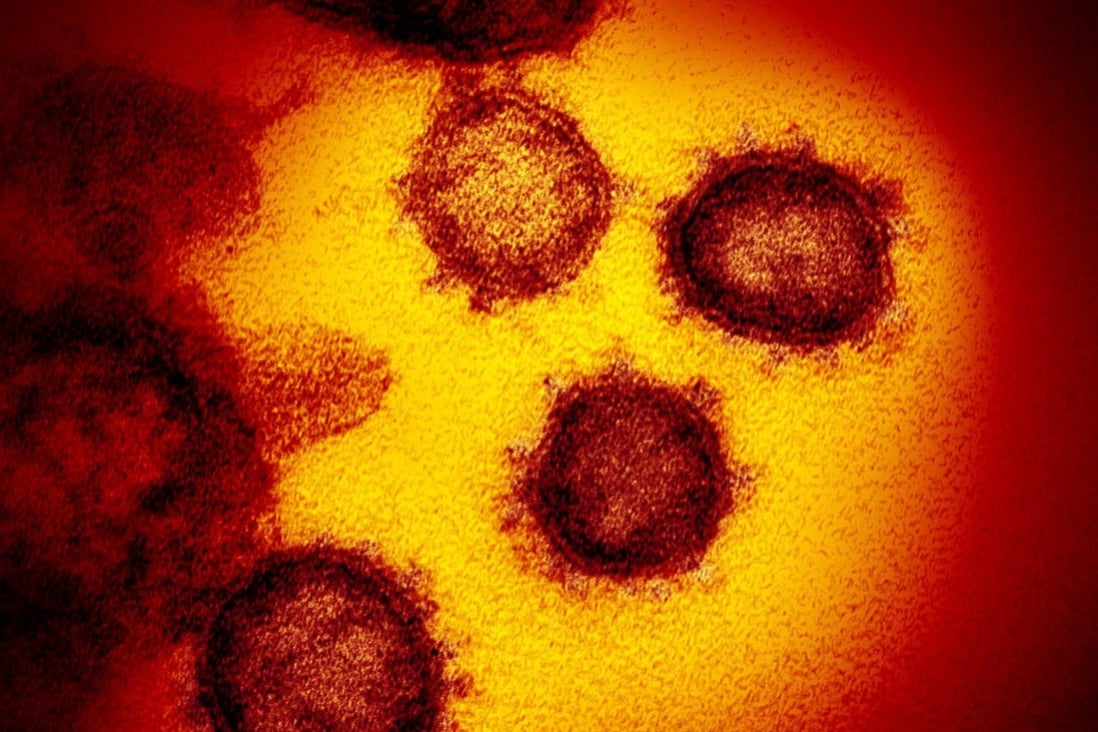 An electron microscope image shows the coronavirus emerging from the surface of cells. Photo: Handout