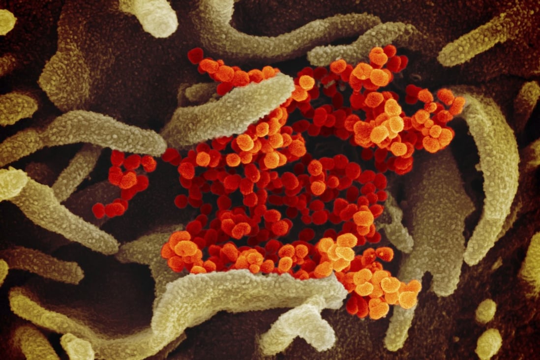 Traces of the coronavirus have been found in patients who have recovered. Photo: AP