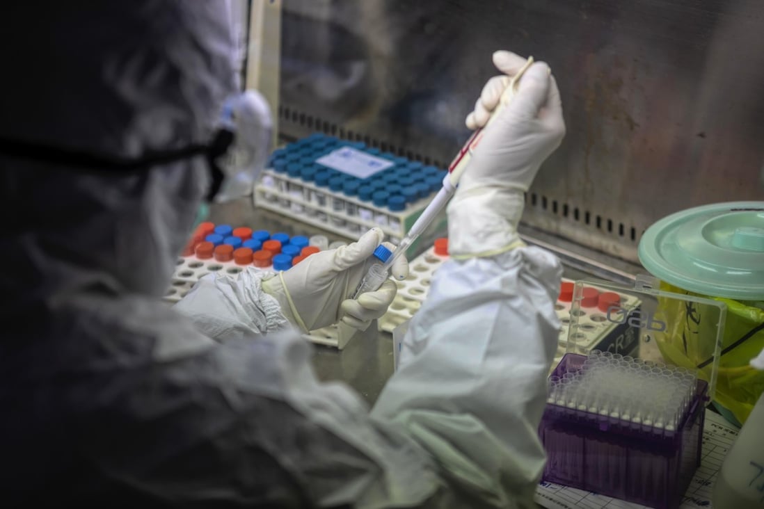 Coronavirus diagnosis kits are developed at a laboratory in Guangdong, China’s second worst-hit province during the outbreak. Photo: EPA-EFE
