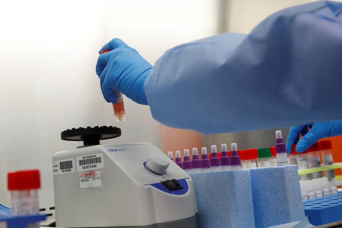 The US is facing a looming shortage of supplies used to extract genetic material from any virus in a patient’s sample. Photo: Reuters