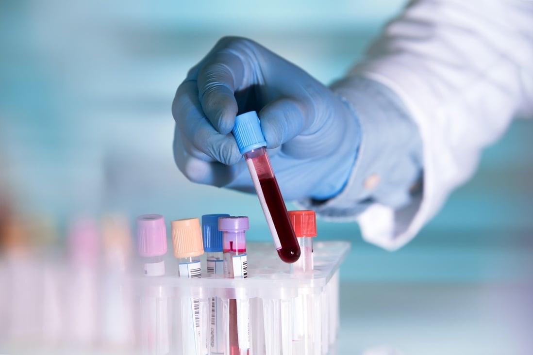 Blood group patterns of more than 2,000 patients with the coronavirus in Wuhan and Shenzhen were compared to local healthy populations. Photo: Shutterstock