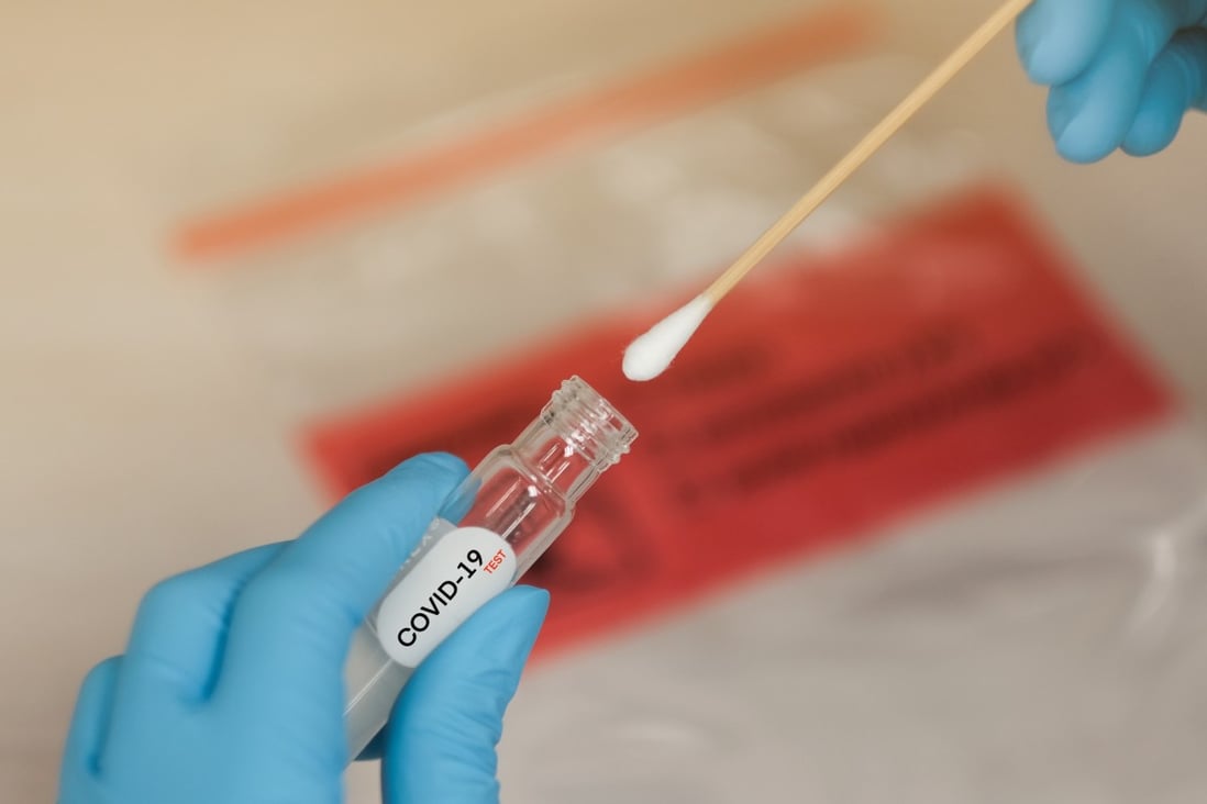 Manila has apologised for suggesting two batches of Covid-19 test kits provided by China were substandard. Photo: Shutterstock