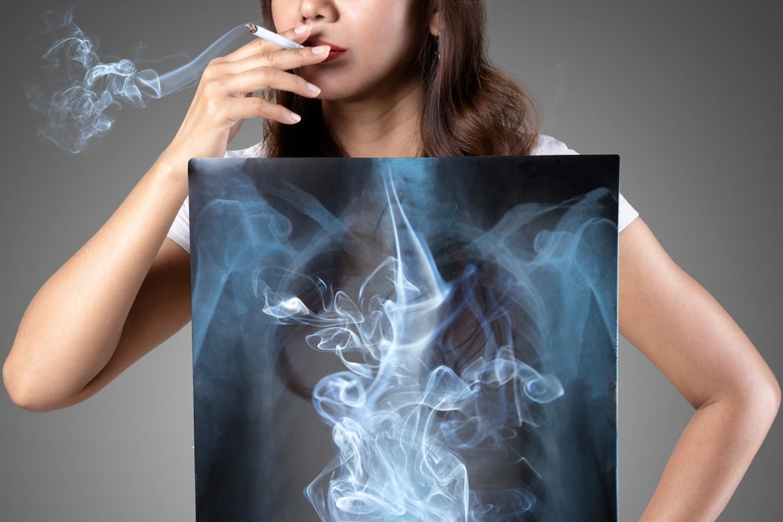 World health bodies and officials are warning that smokers are more likely to get Covid-19 and more likely to become seriously ill, thereby increasing the chances of death. Photo: Shutterstock