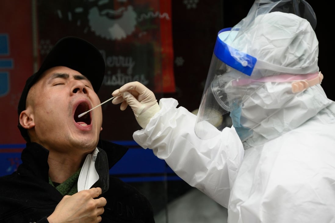 The new coronavirus appears to replicate rapidly in the throat, a German study has found. Photo: AFP