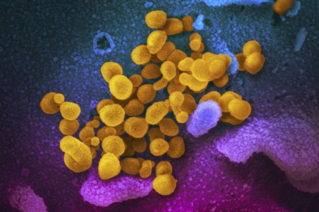 Coronavirus mutation could threaten the race to develop vaccine | South  China Morning Post