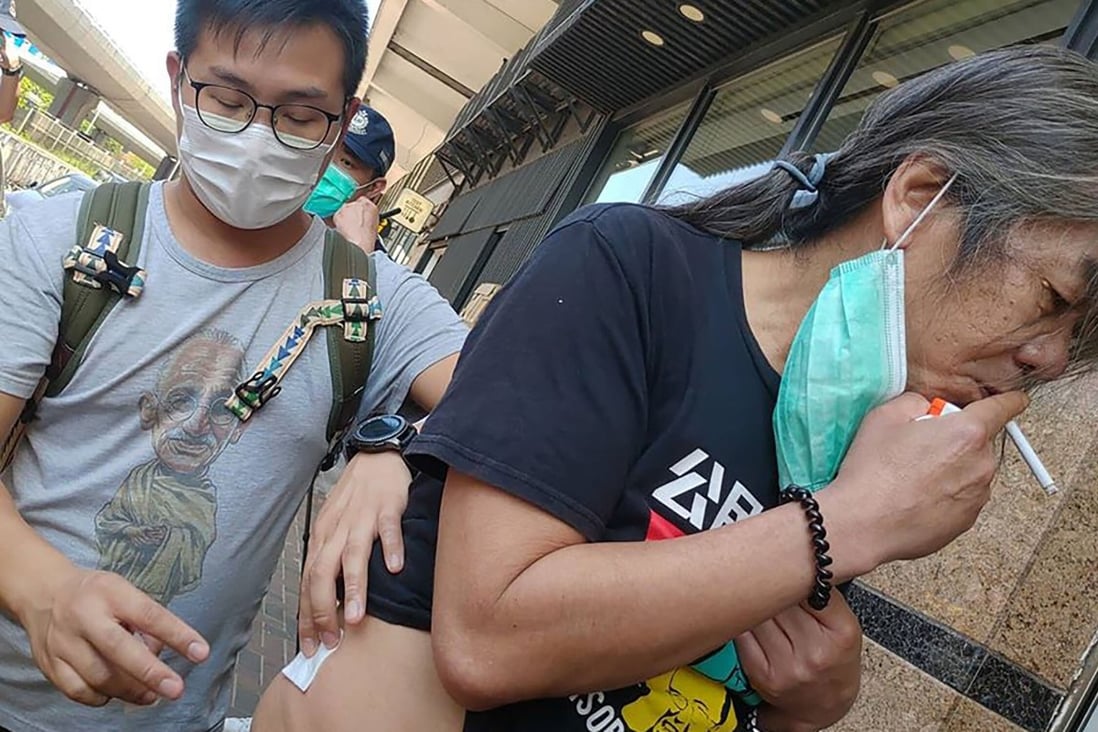 Activist and disqualified lawmaker ‘Long Hair’ Leung Kwok-hung was stabbed while protesting outside the central government’s liaison office in Hong Kong on Thursday but received only minor injuries. Photo: SCMP