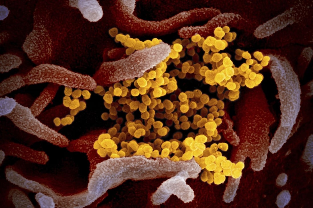 As the coronavirus pandemic continues to accelerate, scientists around the world are racing to develop a vaccine. Photo: AP