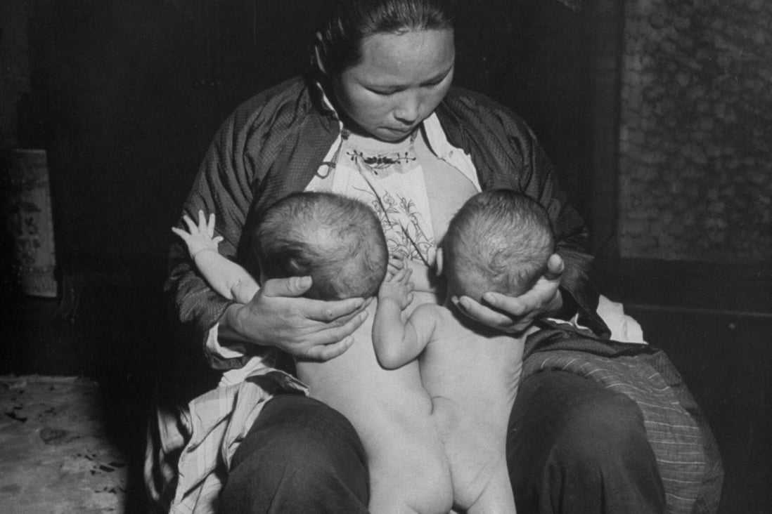 A wet nurse feeds conjoined twins. Photo: Getty Images