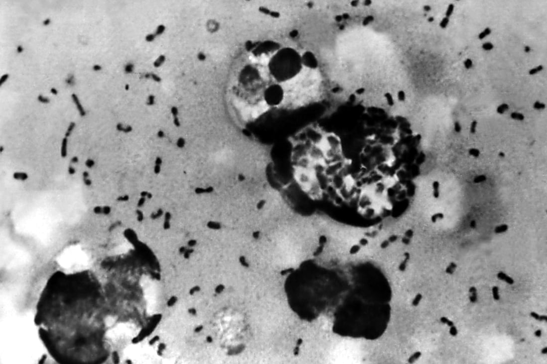 An image of Yersinia pestis bacteria, which cause bubonic plague. Chinese officials confirmed that an Inner Mongolia herder had contracted the disease. Photo: Shutterstock