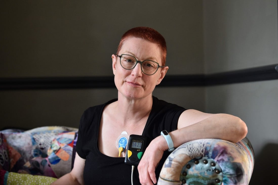 British forensic psychiatrist Jenny Judge, who has been dealing with post-coronavirus symptoms, wears a heart monitor at her home. Photo: Glyn Kirk/AFP
