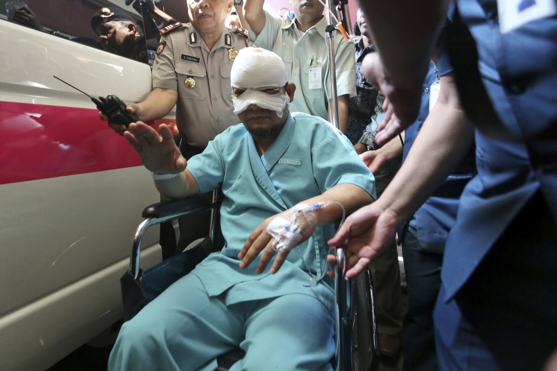 Indonesian Corruption Eradication Commission investigator Novel Baswedan after the attack. Photo: AP