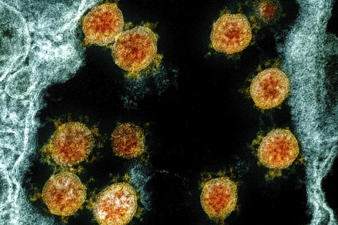 Researchers are on alert for the potential effects of coronavirus mutations. Photo: National Institutes of Health via AP