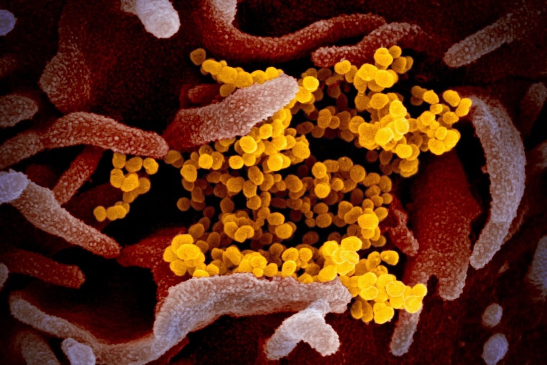 The impact of the coronavirus on the brain remains uncertain. Photo: EPA-EFE
