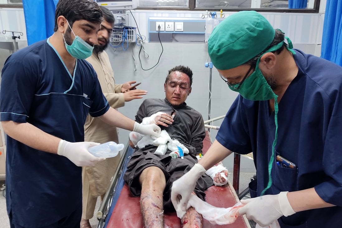 An injured man medical care at a hospital in Peshawar on October 27, 2020. Photo: EPA-EFE