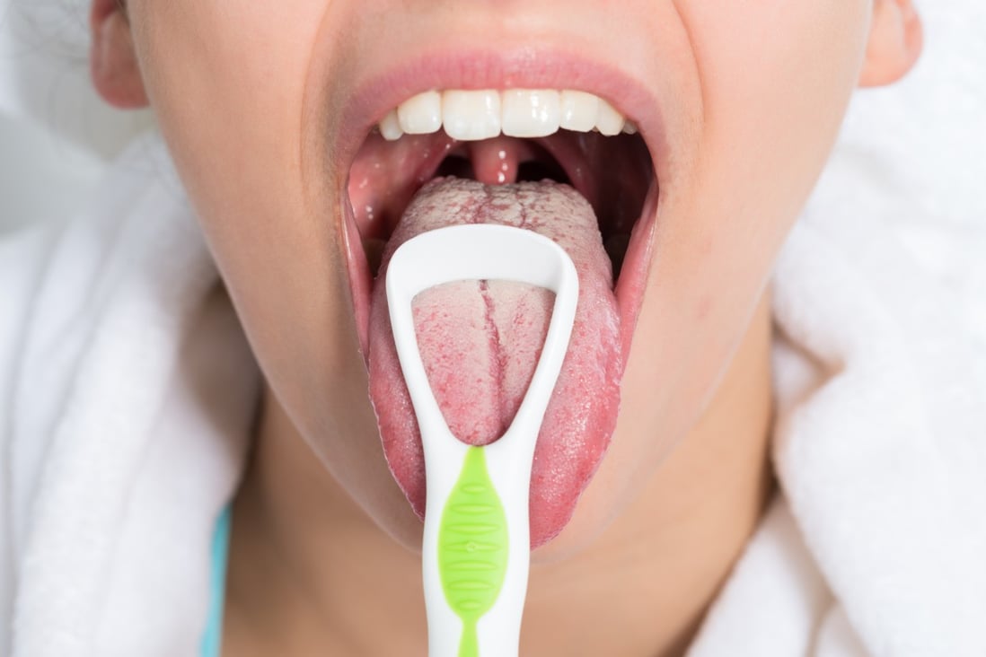 Tongue scraping is an important part of Ayurveda, the traditional Indian medicine system. Photo: Getty Images