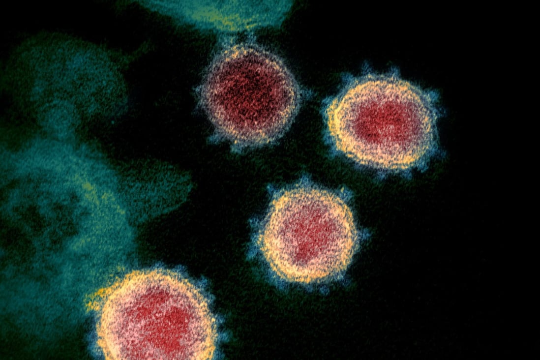 An electron microscope image shows the coronavirus that causes Covid-19. Scientists are trying to create a “pan-coronavirus” vaccine. Photo: AP