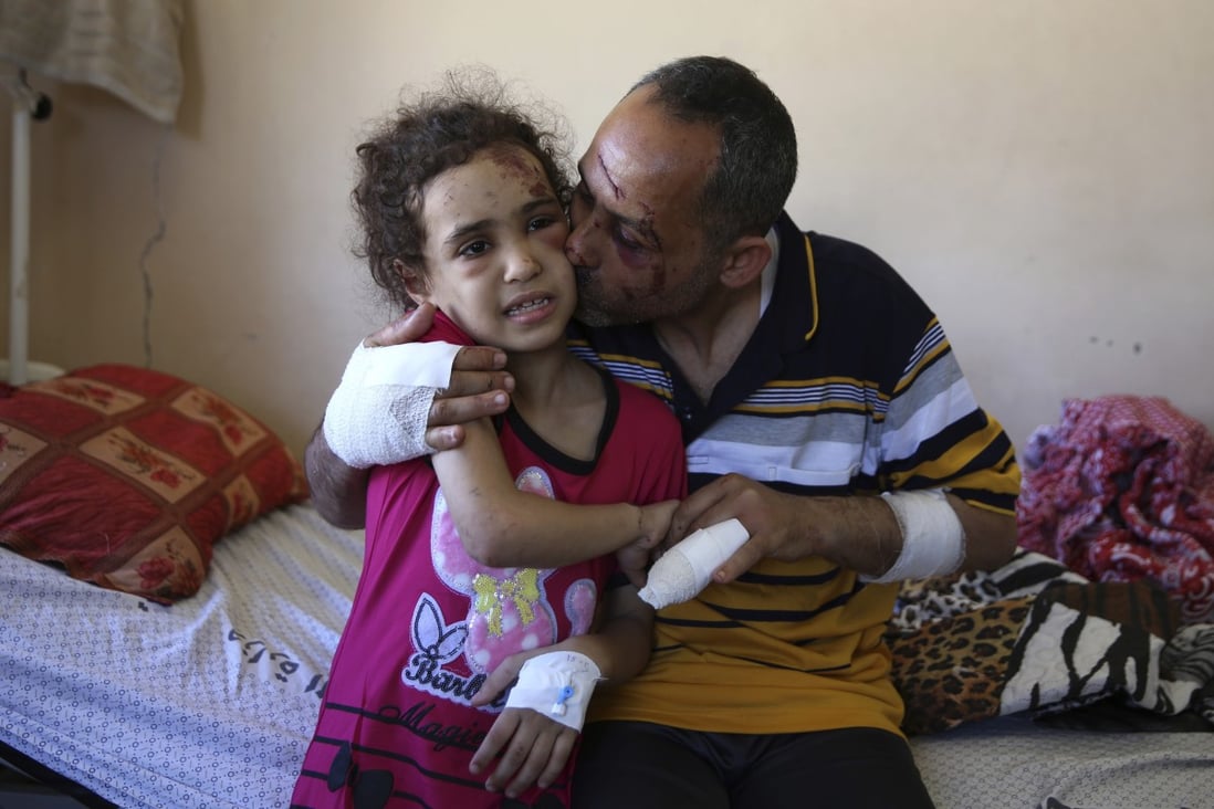 Suzy survived an Israeli strike in Gaza. Dozens of other children haven't | South China Morning Post