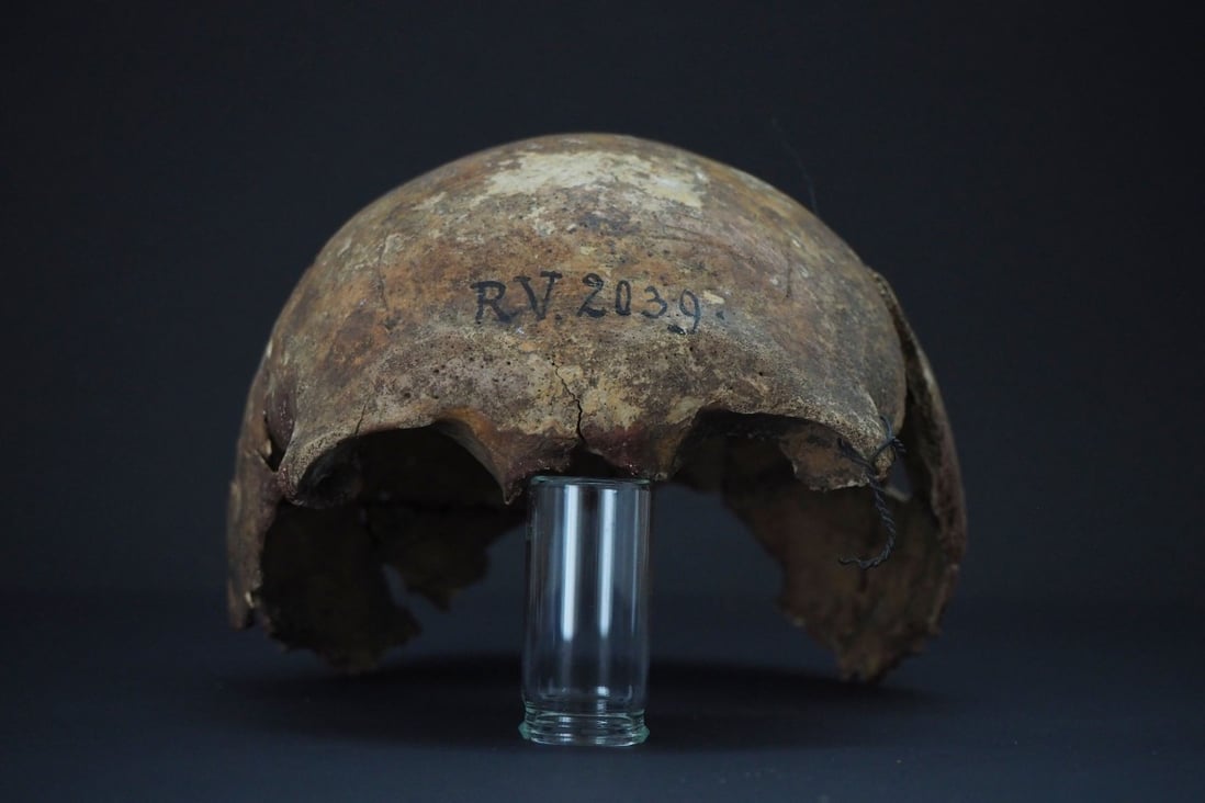 The skull bones of a man buried in Rinnukalns, Latvia around 5,000 years ago. Photo: Dominik Goldner / BGAEU, Berlin / AFP