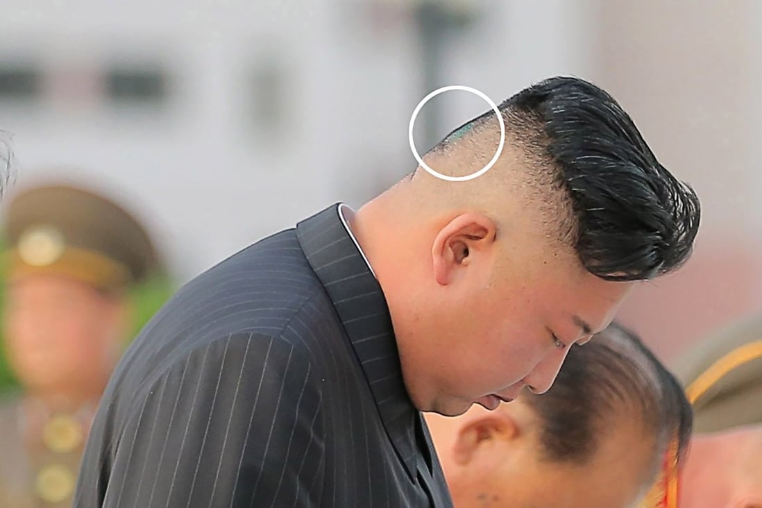 The NK News site and Chosun newspaper said Kim Jong-un’s head bandage was visible when he appeared at an army event last month. There were also images in which the bandage was gone and a greenish spot could be seen. Photo: KCNA
