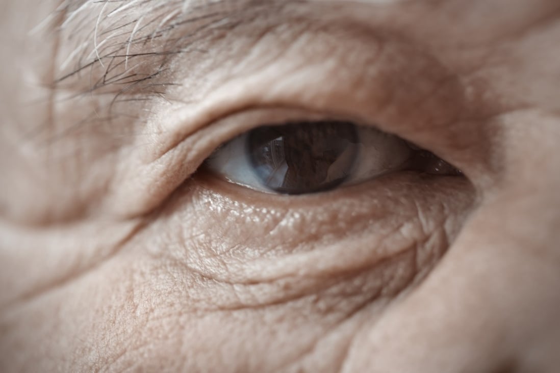 Age and chronic disease is currently responsible for vision loss in about 450 million people worldwide. Photo: Shutterstock