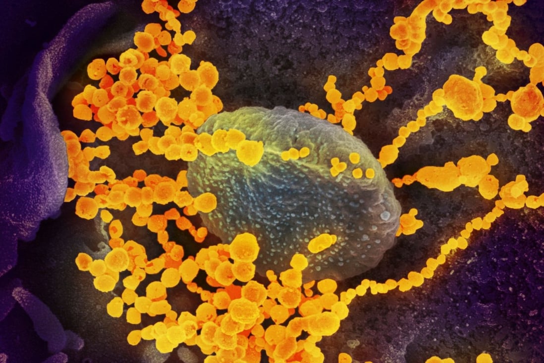 What is the Mu coronavirus variant, and should Hong Kong be worried? | South China Morning Post