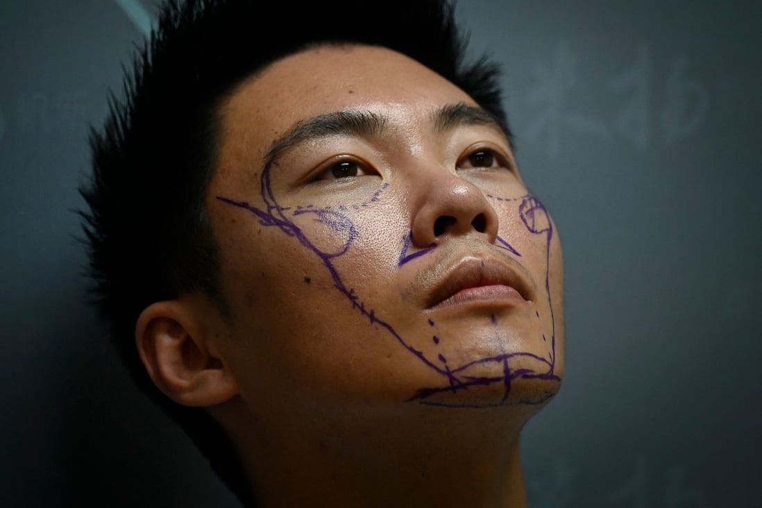 Scientific researcher Xia Shurong is shown with markings on his face before having plastic surgery at a clinic in Beijing. Worried his appearance would detract from opportunities in China's competitive society, Xia Shurong decided to go under the surgeon's knife to reshape his nose. Photo: AFP