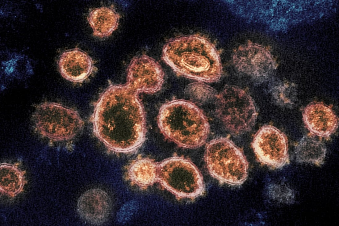An electron microscope image shows Sars-CoV-2 virus particles emerging from the surface of cells cultured in a lab. Israel’s war game simulates a crisis caused by a fictitious new ‘Omega’ variant of the virus. Image: NIAID-RML via AP