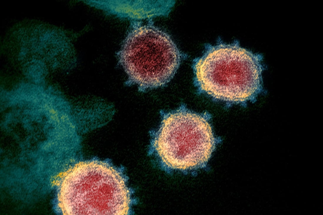 An electron microscope image of the Covid-19 virus. Photo: Handout via AP