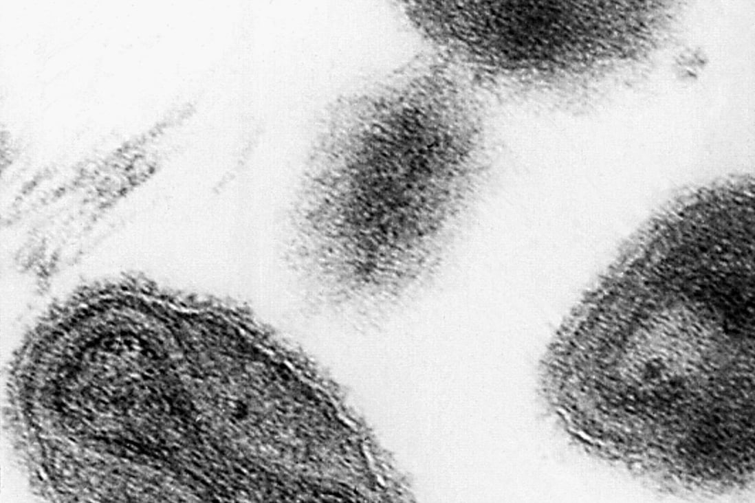 FBI and CDC investigate as vials labelled ‘Smallpox’ found in US lab ...