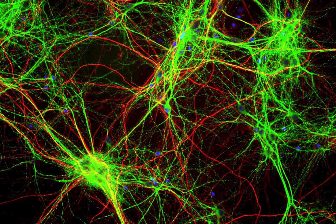 Layers of nerve cells in the retina. Photo: Flickr/NIH Image Gallery
