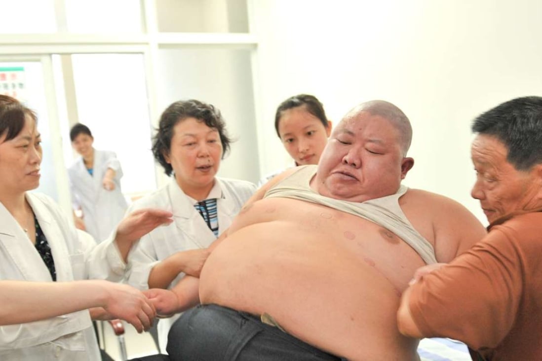 Obesity is among the factors behind an explosion in diabetes cases in China since 1980. Photo: Xinhua