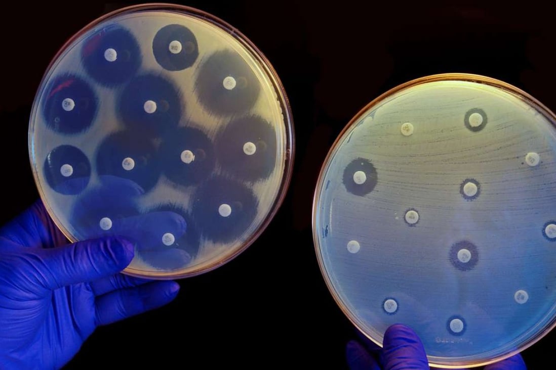 The plate on the left contains bacteria that are susceptible to antibiotics while the one on the right contains antibiotic-resistant bacteria. Picture: Alamy