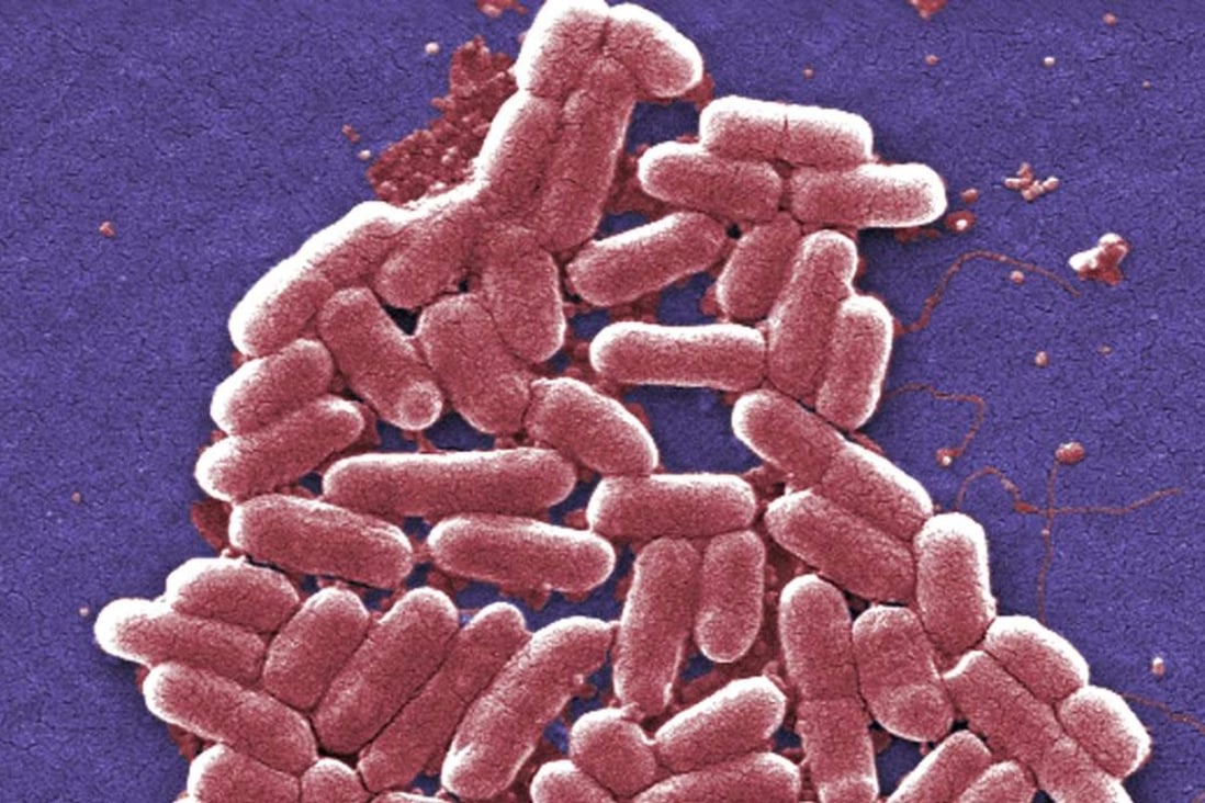 An antibiotic-resistant strain of the E. coli bacteria. Photo: Centres for Disease Control