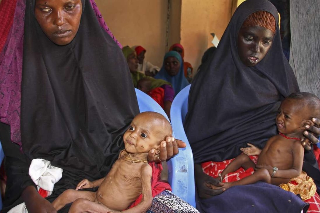 Malnourished baby Ali Hassan, 9-months-old, left, is held by his mother Fadumo Abdi Ibrahim, as mother Habiba Mohamed Aden holds her baby Mohamud Ahmed, 6-months-old, right, all of whom fled the drought in southern Somalia, at a feeding centre in a camp in Mogadishu, Somalia. Photo: AP