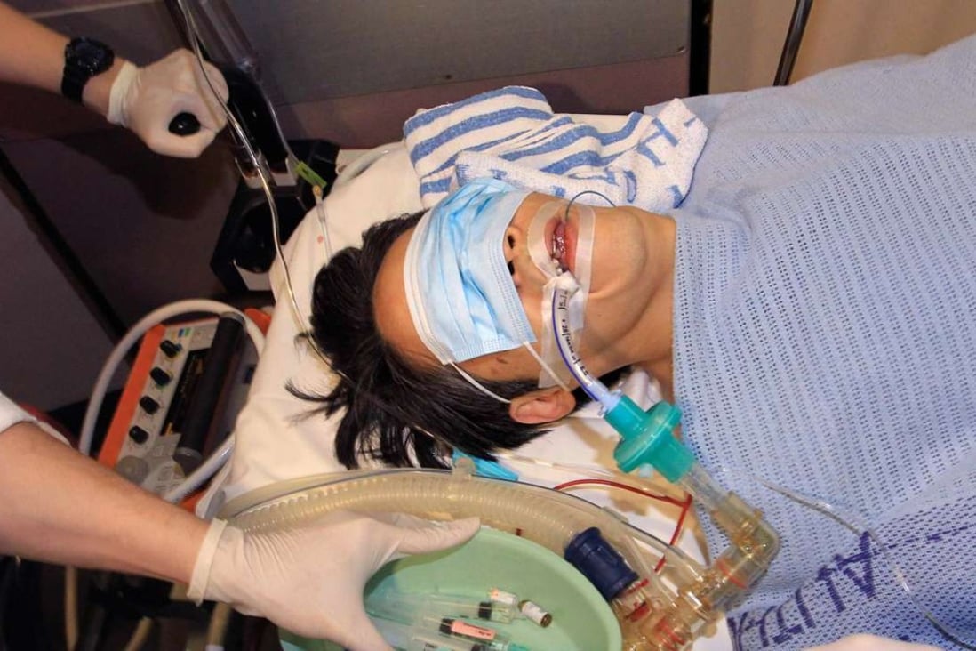 Former Ming Pao chief editor Kevin Lau was the victim of a knife attack in 2014.